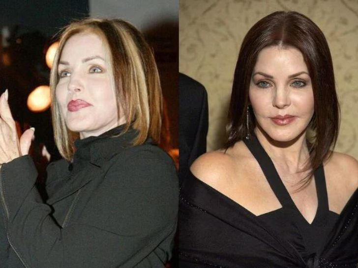 The Truth About Priscilla Presley's Plastic Surgery Rumors