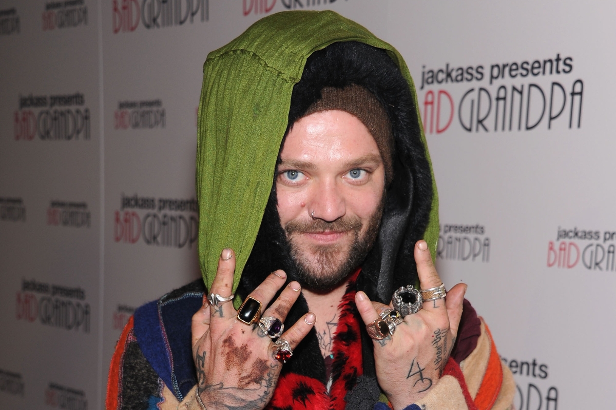 bam-margera-hospitalized-following-skateboarding-accident