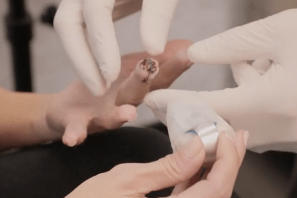 kim-kardashian-shows-off-gruesome-injury-after-tip-of-her-finger-broke-off