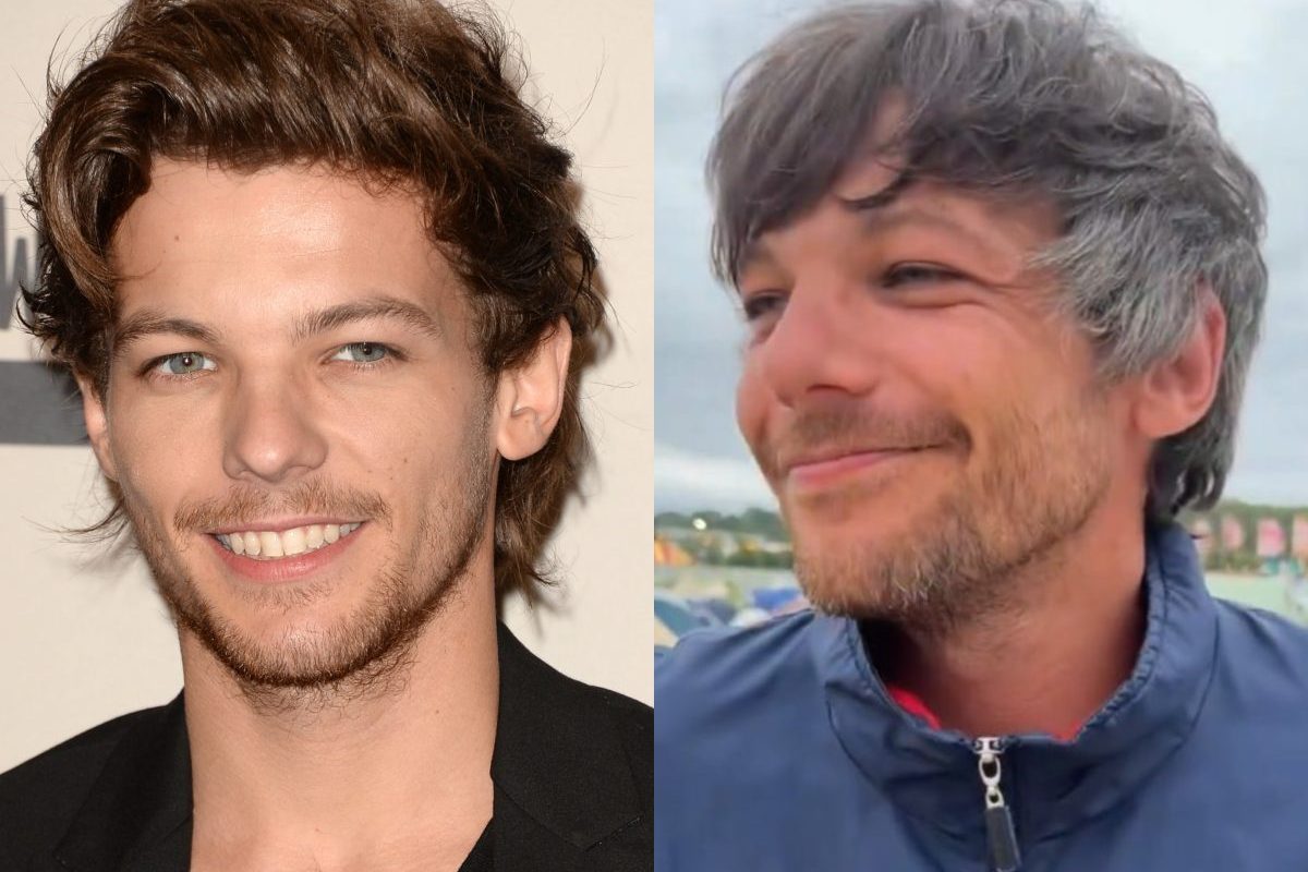 one-direction-alum-louis-tomlinson-shocks-fans-with-hair-transformation