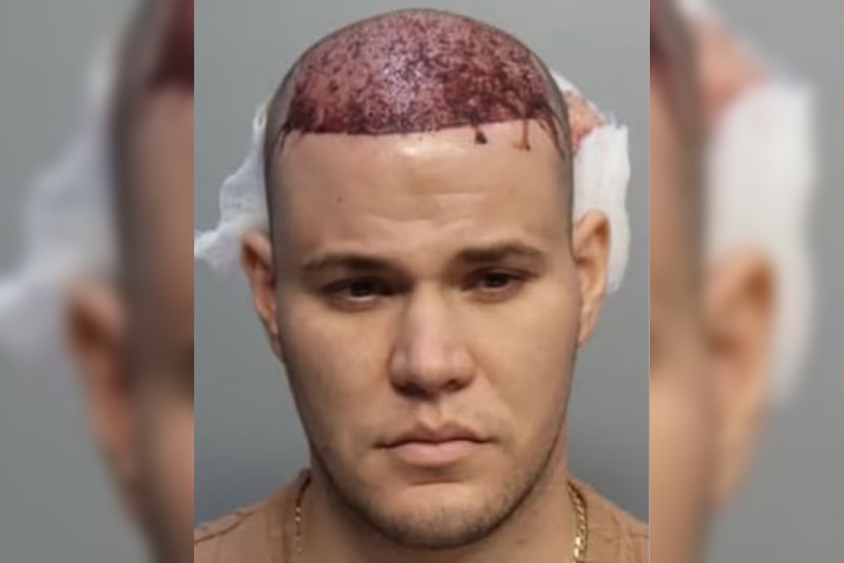 couples-mugshots-go-viral-following-arrest-on-american-airlines-plane-over-bloody-hair-transplant