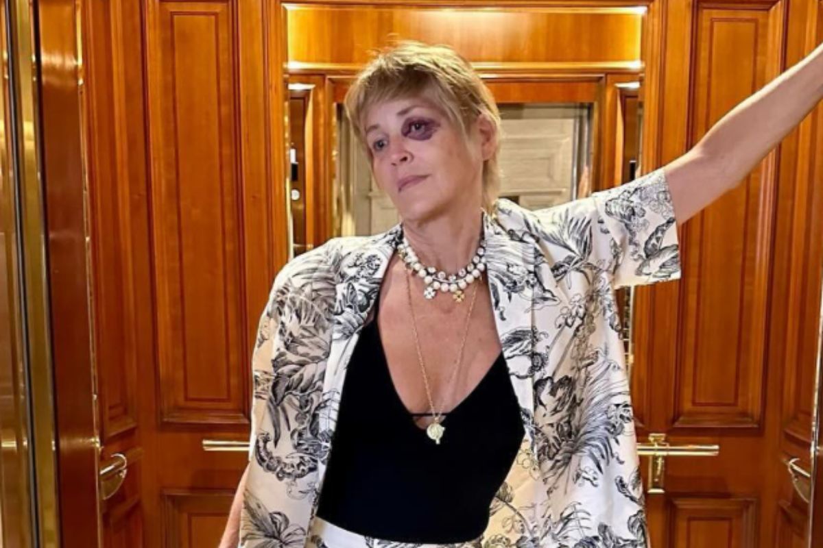 sharon-stone-sports-wicked-black-eye-during-vacation-in-turkey