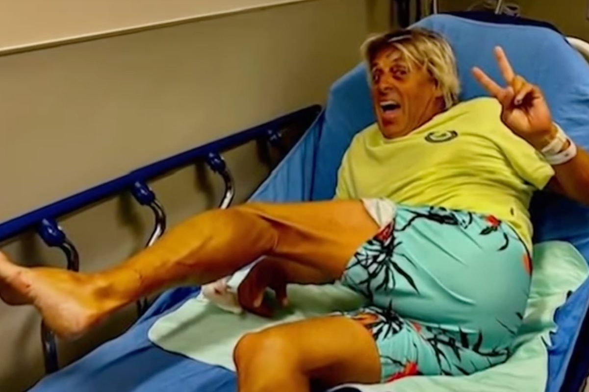 surfer-drives-himself-to-hospital-after-brutal-shark-attack-it-was-so-gnarly