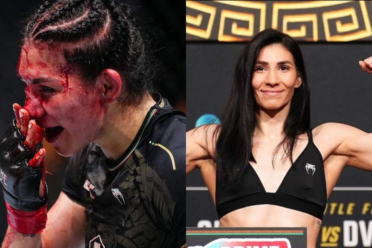 ufc-star-irene-aldana-shows-off-massive-gash-from-fight-in-gruesome-video