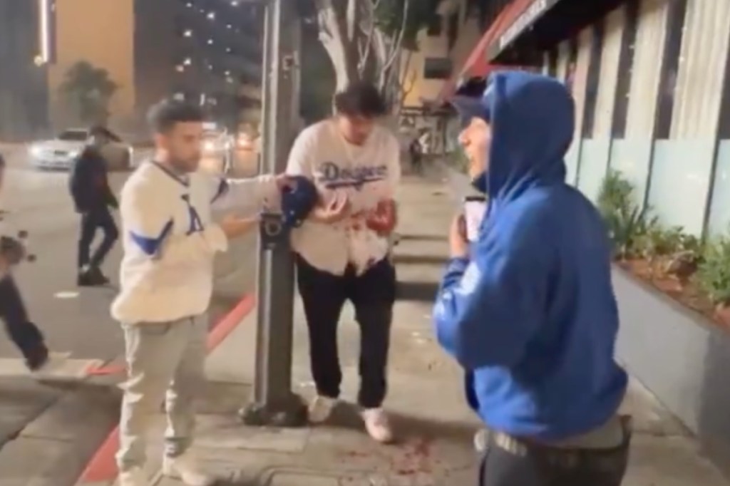 dodgers-fan-blows-off-hand-with-fireworks-during-world-series-celebration-in-crazy-video