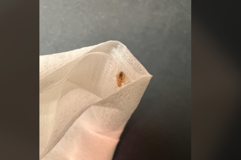 first-class-passenger-finds-bed-bug-climbing-up-leg-during-flight