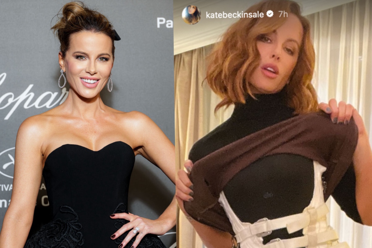 kate-beckinsale-shows-off-horrific-on-set-injuries-in-graphic-photos