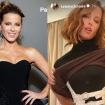 kate-beckinsale-shows-off-horrific-on-set-injuries-in-graphic-photos