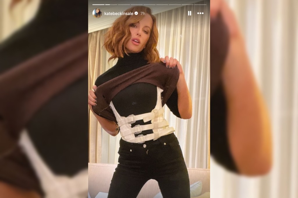 kate-beckinsale-shows-off-horrific-on-set-injuries-in-graphic-pic