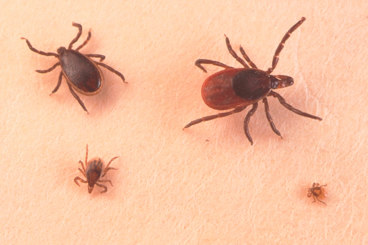 womans-itchy-ear-pain-reveals-tick-and-its-8-surprising-offspring