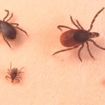 womans-itchy-ear-pain-reveals-tick-and-its-8-surprising-offspring