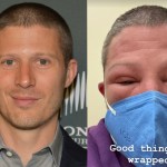 friday-night-lights-star-zach-gilford-shares-shocking-photos-of-swollen-face