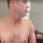 mans-attorney-claims-he-was-cooked-on-asphalt-and-suffered-third-degree-burns-when-cops-pinned-him-during-arrest